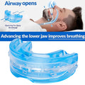 Calena GUARD Anti-Bruxism Night Mouthguard