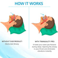 Calena GUARD Anti-Bruxism Night Mouthguard
